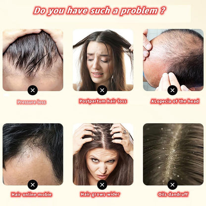 ANTI-HAIR LOSS HAIR SHAMPOO Black What Spirit (Pack of 2)